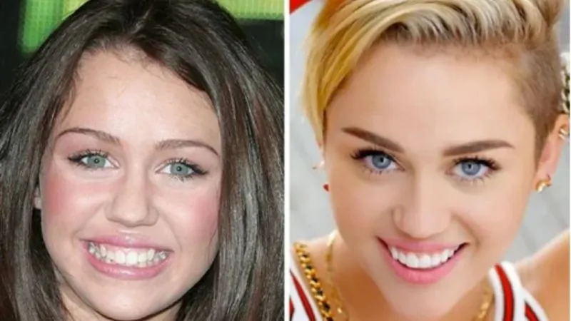Miley Cyrus before and after