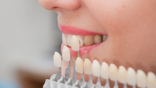 What Is Dental Porcelain?