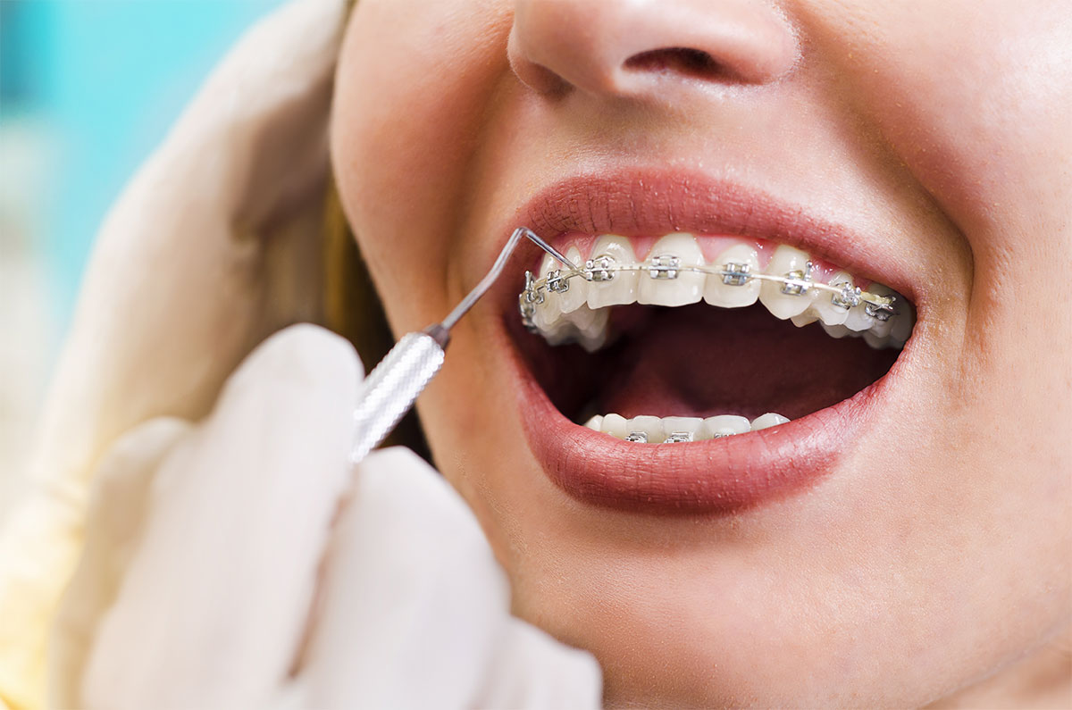 Top 5 Reasons of Working with a Certified Dental Clinic in Turkey for Foreigners